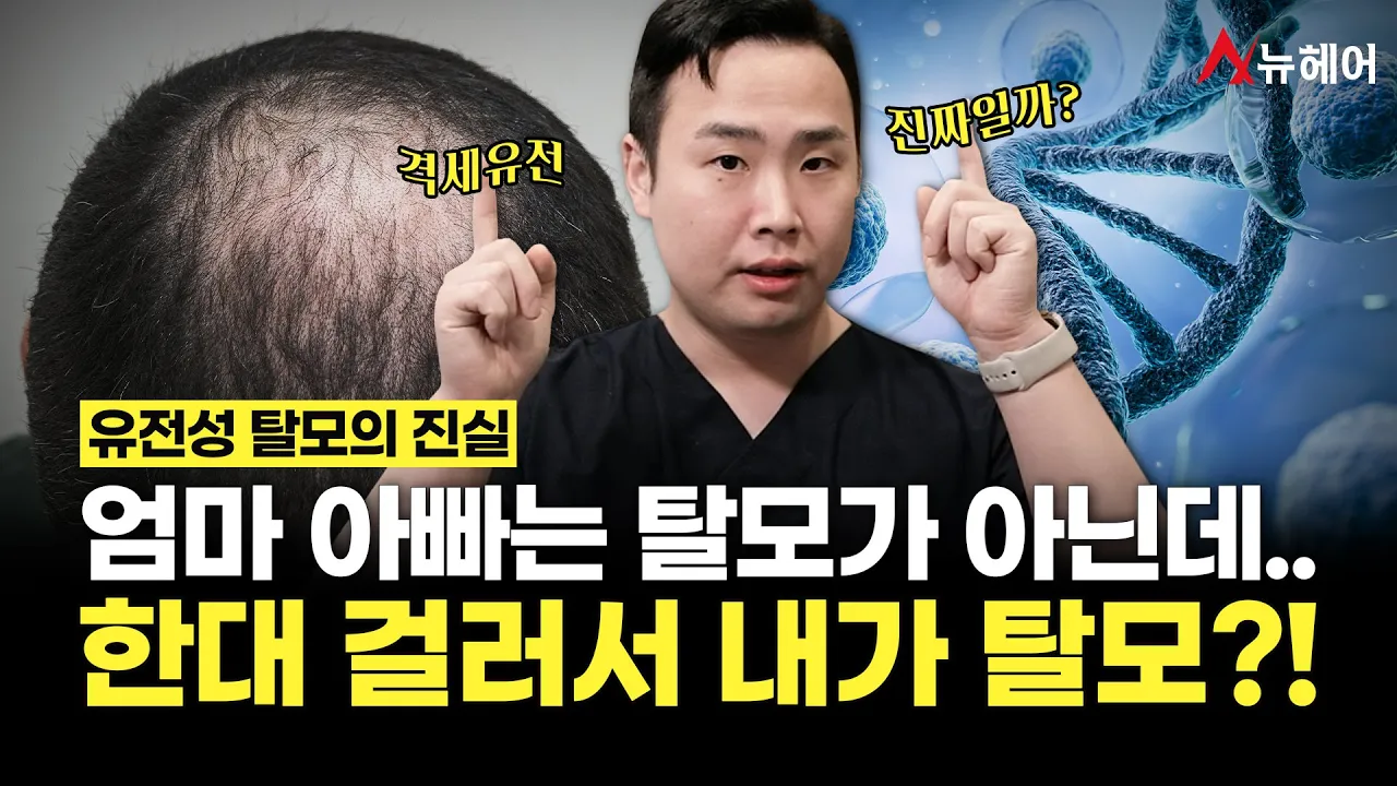 유전성 탈모에 대해 대부분 잘못 알고 있는 진실