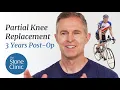 Partial Knee Replacement Surgery Patient Story 2 year post-op