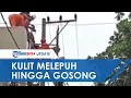 Download Lagu Detik Detik Pekerja Bangunan Kesetrum di Atap Rumah, Kondisi Kritis dan Kulit Melepuh Hingga Gosong
