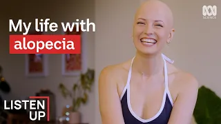 "I've Been Bald Since I Was 6 Years Old"