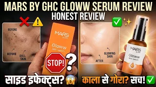 Mars by GHC Gloww Serum Review: Sach ya Dhokha? 😱 | Side Effects & Ingredients