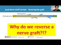 Why reverse a sural nerve graft