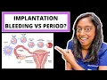 IMPLANTATION BLEEDING VS PERIOD HOW TO TELL THE DIFFERENCE