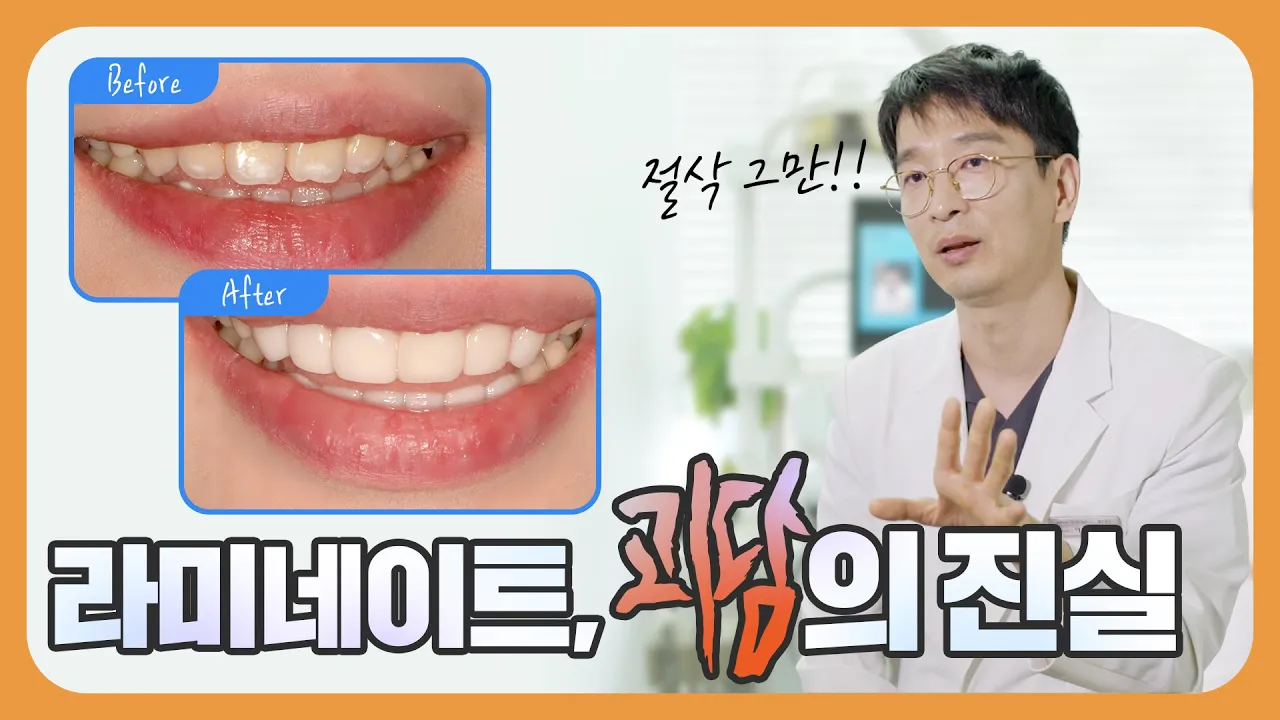 괴담은 삭제, 라미네이트는 무삭제🦷 최소한의 치아 삭제로 라미네이트 해보세요😁 |무삭제 라미네이트|라미네이트 괴담