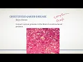 Homeostatic Imbalances of Nervous System