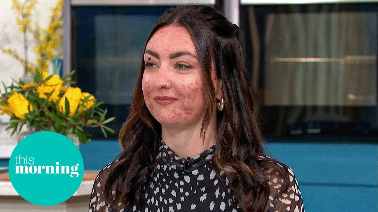 Outline Video The Truth About Adult Acne: Expert Advice for Clear Skin | This Morning