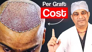 Hair Transplant Cost Around the World: Where’s the Best Deal? | Hair Transplant Results