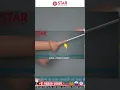 Download Lagu Penis का खतना करवाना चाहिए  | Stapler Circumcision |  Bloodless, Painless \u0026 Fast Recovery