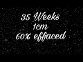 35 weeks 1cm 60 effaced