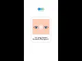 Download Lagu Ini Yang Dialami Penderita Pterygium