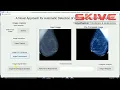Detection of Abnormalities in Mammograms Matlab Image Processing Project