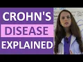 Download Lagu Crohn's Disease Nursing | Crohns Symptoms, Pathophysiology, Treatment, Diet NCLEX