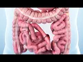 CPT code for Enterectomy - simplify medical coding
