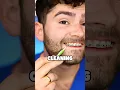 Best Way to Clean Braces