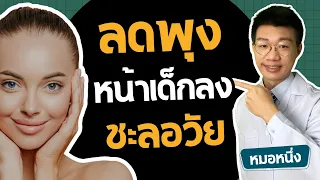 ควรกินโปรตีนมากแค่ไหนเวลาลดน้ำหนัก