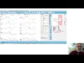 Introduction to the Audera Pro