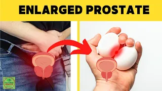 Download The Top 6 Vitamins To SHRINK and ENLARGED PROSTATE MP3