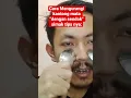 Download Lagu CARA AMPUH HILANGIN KANTUNG MATA DENGAN SENDOK