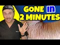 2 Minute Fix For Crepey Skin That Actually Works Chris Gibson