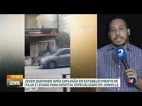 Adolescente queimado em oficina de motos em Itajaí é transferido para outra unidade hospitalar