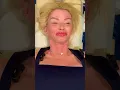 Got migraines This is the adjustment for you