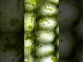 Download Lagu Plant cells under microscope