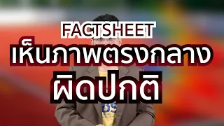 ทำไมการมองเห็นภาพผิดปกติที่เป็นชั่วคราวถึงควรไปพบแพทย์