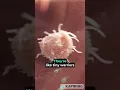Download Lagu WHITE BLOOD CELL fights with BACTERIA ! 😳