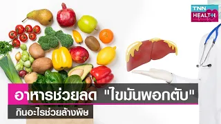  โรคไขมันพอกตับเกิดจากอะไร และสามารถรักษาได้หรือไม่ 