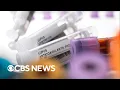 Download Lagu Study finds possible lupus cause, way to reverse disease