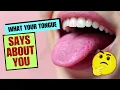 Download Lagu Verschillende soorten tongproblemen en hun oorzaken die u niet mag negeren