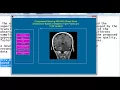 digital image processing projects for final year digital image processing thesis for final year