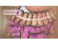 Treating Low Blood Sugar Hypoglycemia Nucleus Health