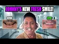 Johnny Depp s Rotten Teeth to Shiny Veneers
