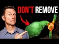 Download Lagu Never Get Your Gallbladder Removed