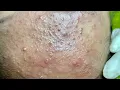 Download Lagu Satisfying video with Chung Vo Spa | 382