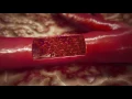 Valerie Jenness UCI Professor Doctors Explain Treating Strokes