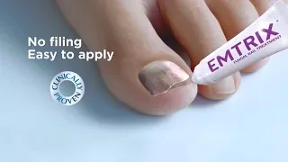 Emtrix Fungal Nail Treatment
