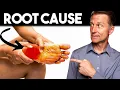 Download Lagu Peripheral NEUROPATHY (Root Cause and Best Remedy) — Dr. Berg