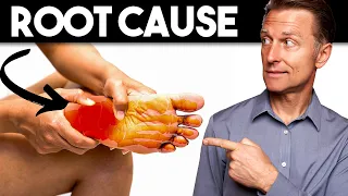 peripheral neuropathy root cause and best remedy dr berg