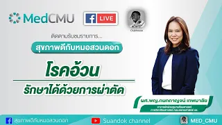 การผ่าตัดกระเพาะอาหารเพื่อลดน้ำหนักทำงานอย่างไร