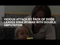 Vicious attack by dogs package leaves a double amputation Iowa woman