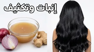 توقفي عن إضاعة المال! معجزة البصل والزنجبيل لإنبات الفراغات وتكثيف الشعر بجنون وداعاً للصلع والشيب