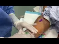 Download Lagu TR band - patent hemostasis