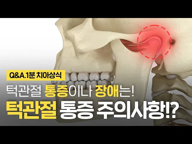 턱관절 주의사항! 통증 장애 치료는? ⏰1분 치아상식 꿀팁!!