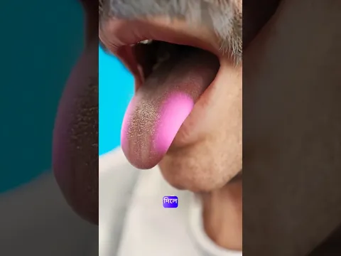 Spoon Magic! HOW?😱|| #shorts