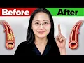 Download Lagu The #1 Best Natural Foods to Clean Out Arteries