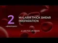 Malaria Thick Smear Preparation