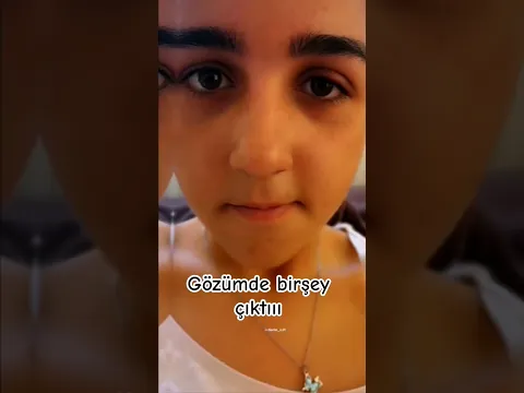 gözümde birşey çıktı #ardaveipek