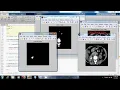Kidney Stone Detection and Classification Medical Image Processing MATLAB